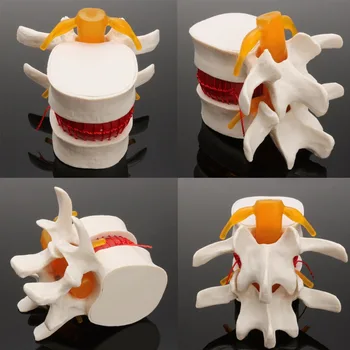 Човешка анатомия Скелет на гръбначния стълб Лумбален диск Херния Преподаване Модел Мозък Череп Травматичен пистолет Училищни пособия Медицински Instrume